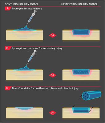 Biomaterials for Local, Controlled Drug Delivery to the Injured Spinal Cord